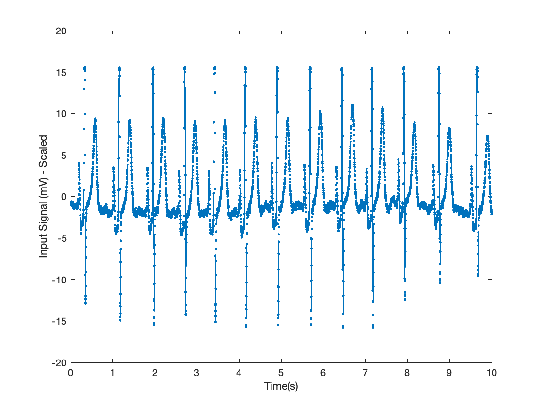 EKG Data unfiltered from the DAQ